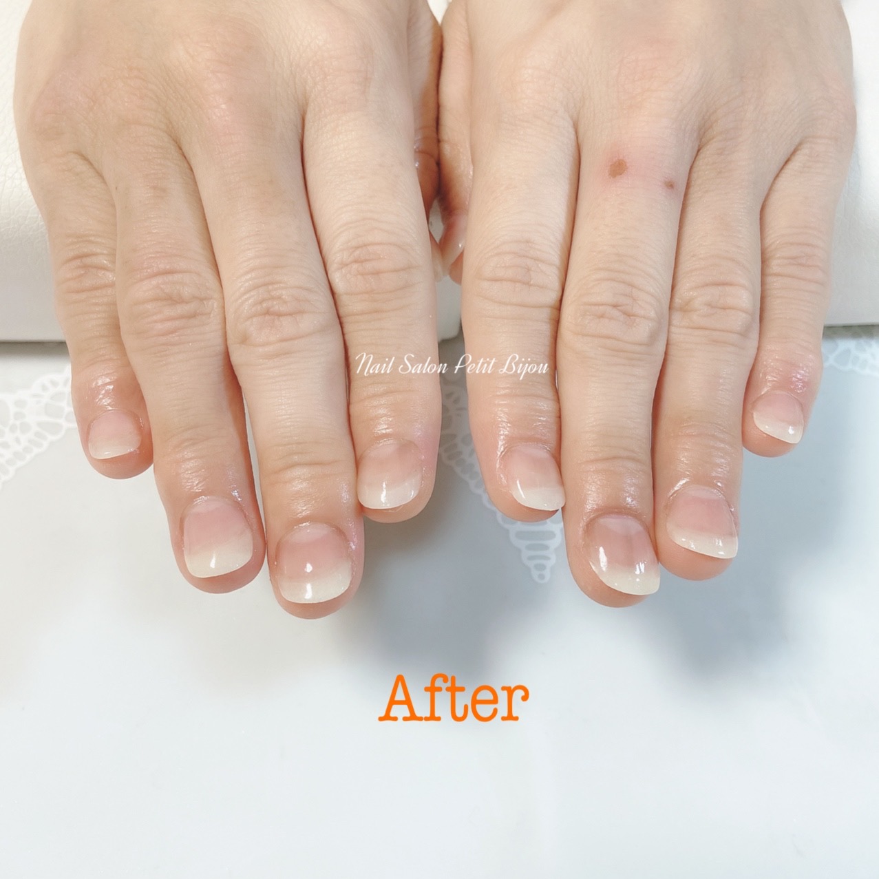 深爪対応メニュー参考写真