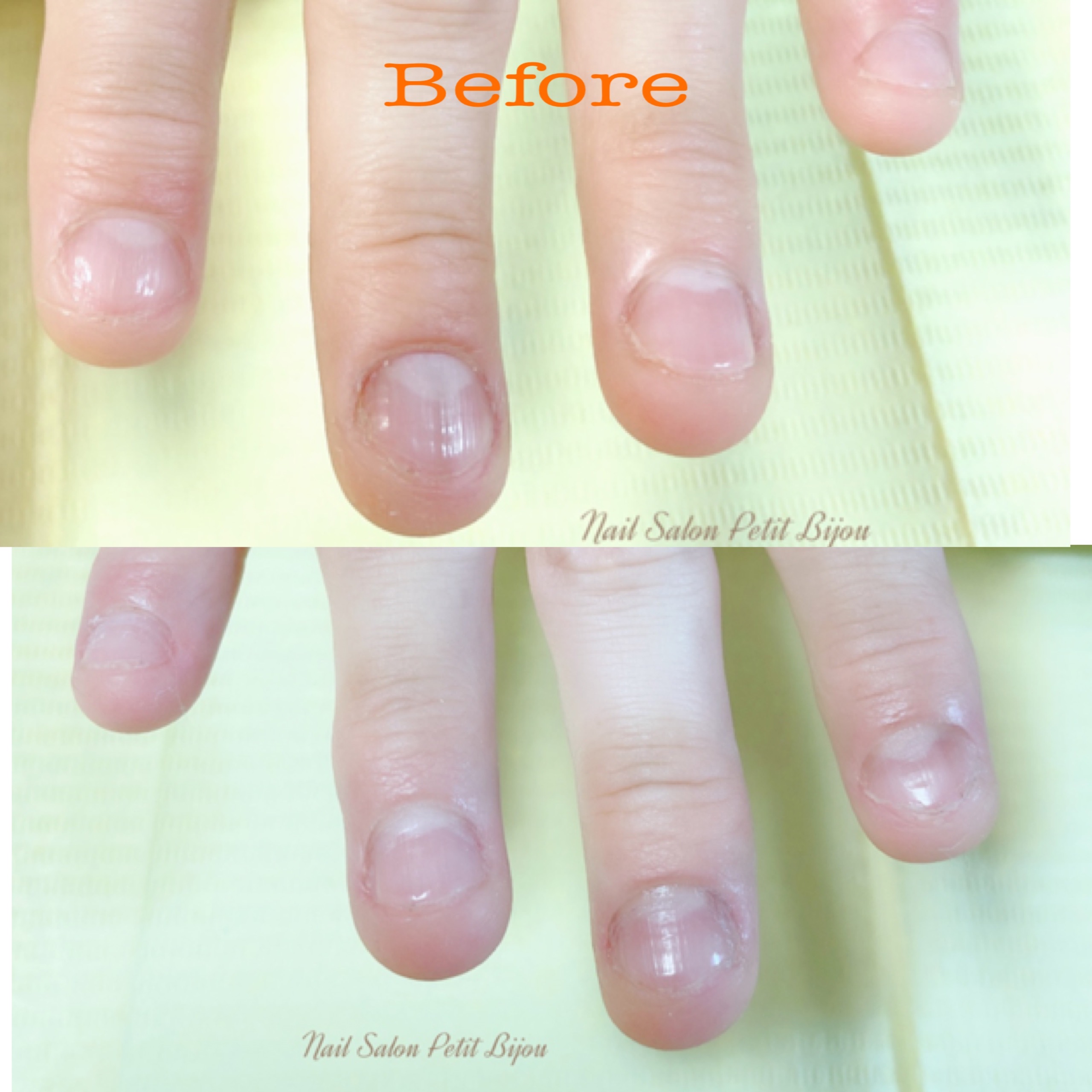 深爪対応メニュー参考写真