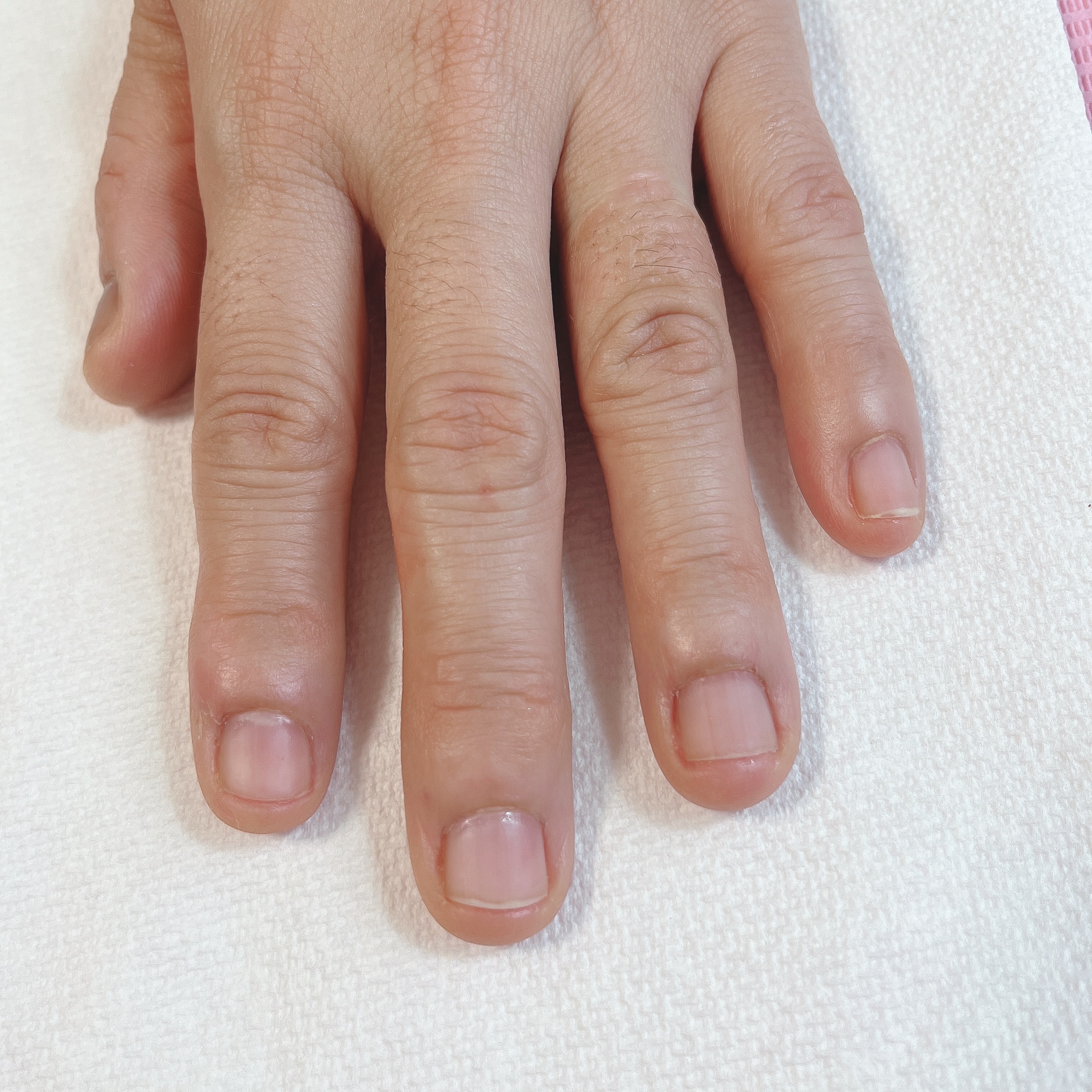 深爪対応メニュー参考写真