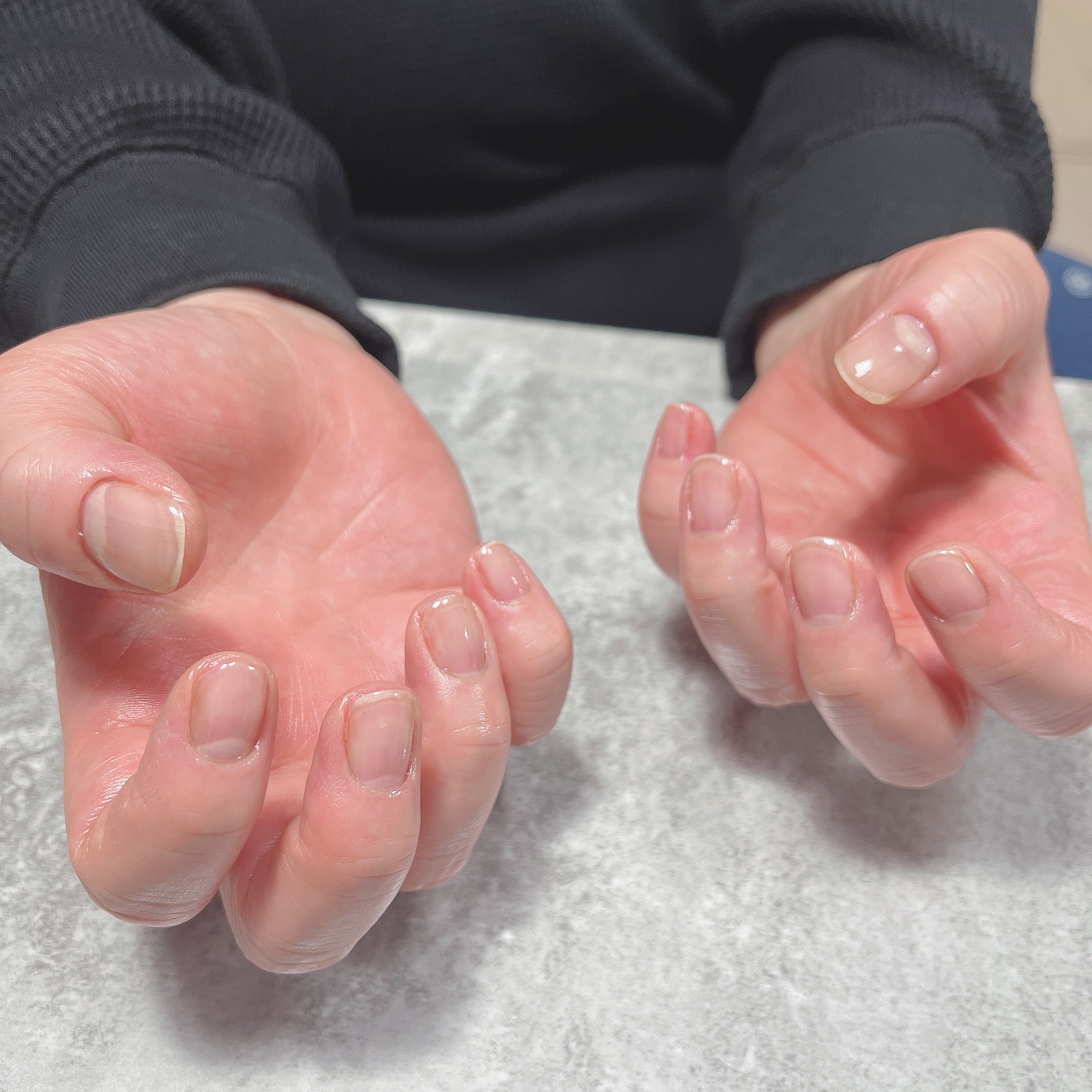 深爪対応メニュー参考写真